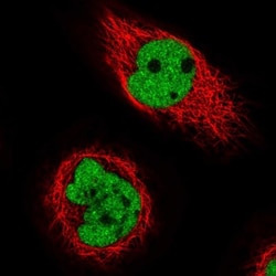 BAP18 Antibody, Novus Biologicals 0.1mL; Unlabeled:Antibodies, Polyclonal
